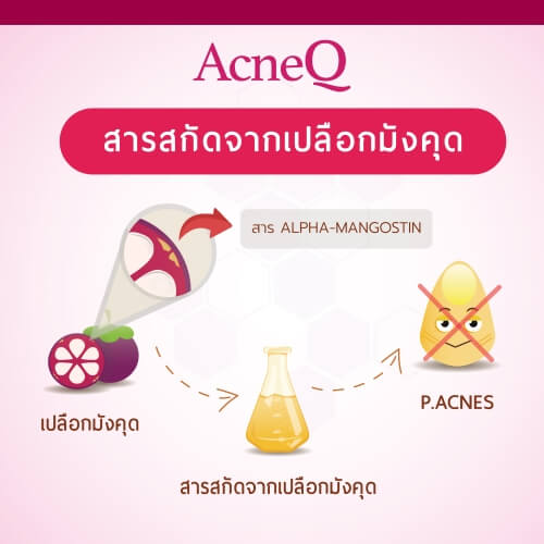 เปลือกมังคุด เป็นสารสกัดสำคัญในแผ่นดูดสิว AcneQ

&nbsp;
