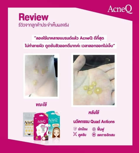 รีวิว เสียงตอบรับจากลูกค้า
